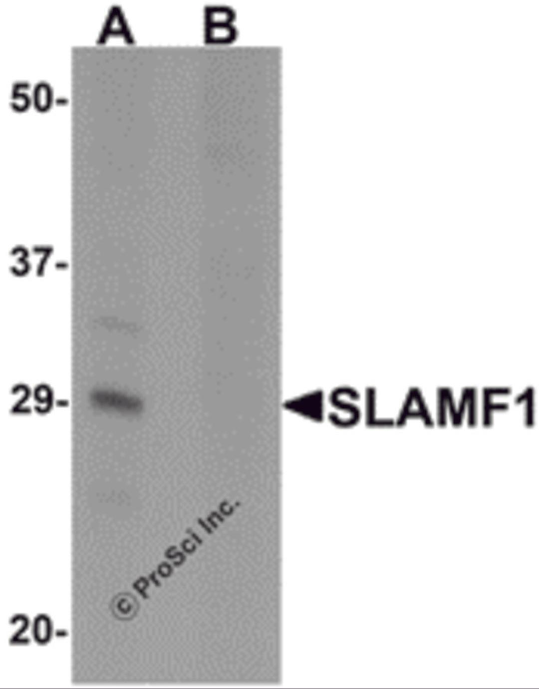 Western blot analysis of SLAMF1 in rat colon tissue lysate with SLAMF1 antibody at 1 &#956;g/mL in (A) the absence and (B) the presence of blocking peptide.