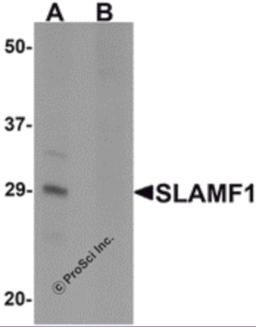 Western blot analysis of SLAMF1 in rat colon tissue lysate with SLAMF1 antibody at 1 &#956;g/mL in (A) the absence and (B) the presence of blocking peptide.