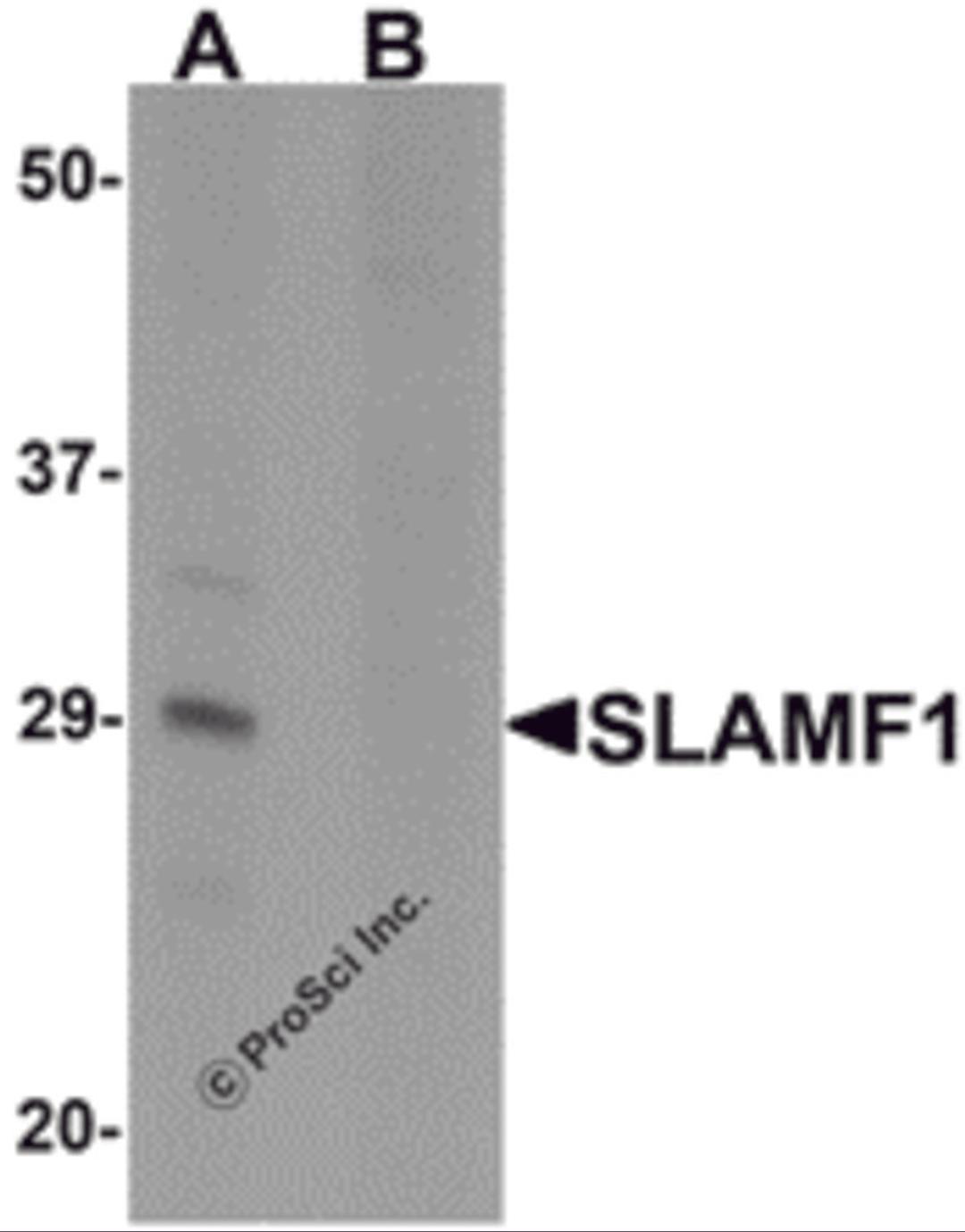 Western blot analysis of SLAMF1 in rat colon tissue lysate with SLAMF1 antibody at 1 μg/mL in (A) the absence and (B) the presence of blocking peptide.