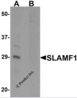 Western blot analysis of SLAMF1 in rat colon tissue lysate with SLAMF1 antibody at 1 μg/mL in (A) the absence and (B) the presence of blocking peptide.