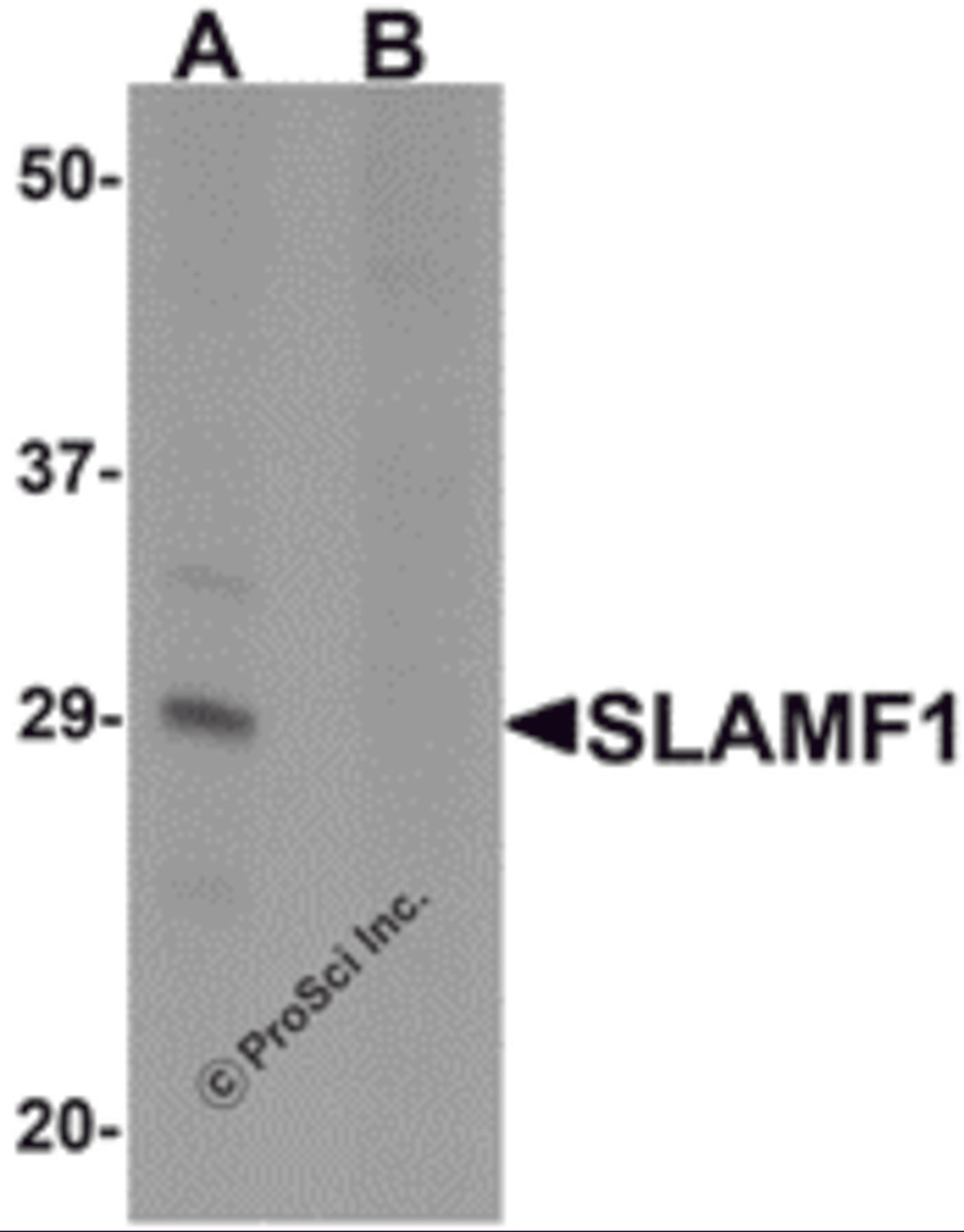 Western blot analysis of SLAMF1 in rat colon tissue lysate with SLAMF1 antibody at 1 μg/mL in (A) the absence and (B) the presence of blocking peptide.