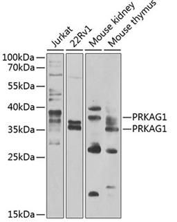 Western blot - PRKAG1 antibody (A7300)