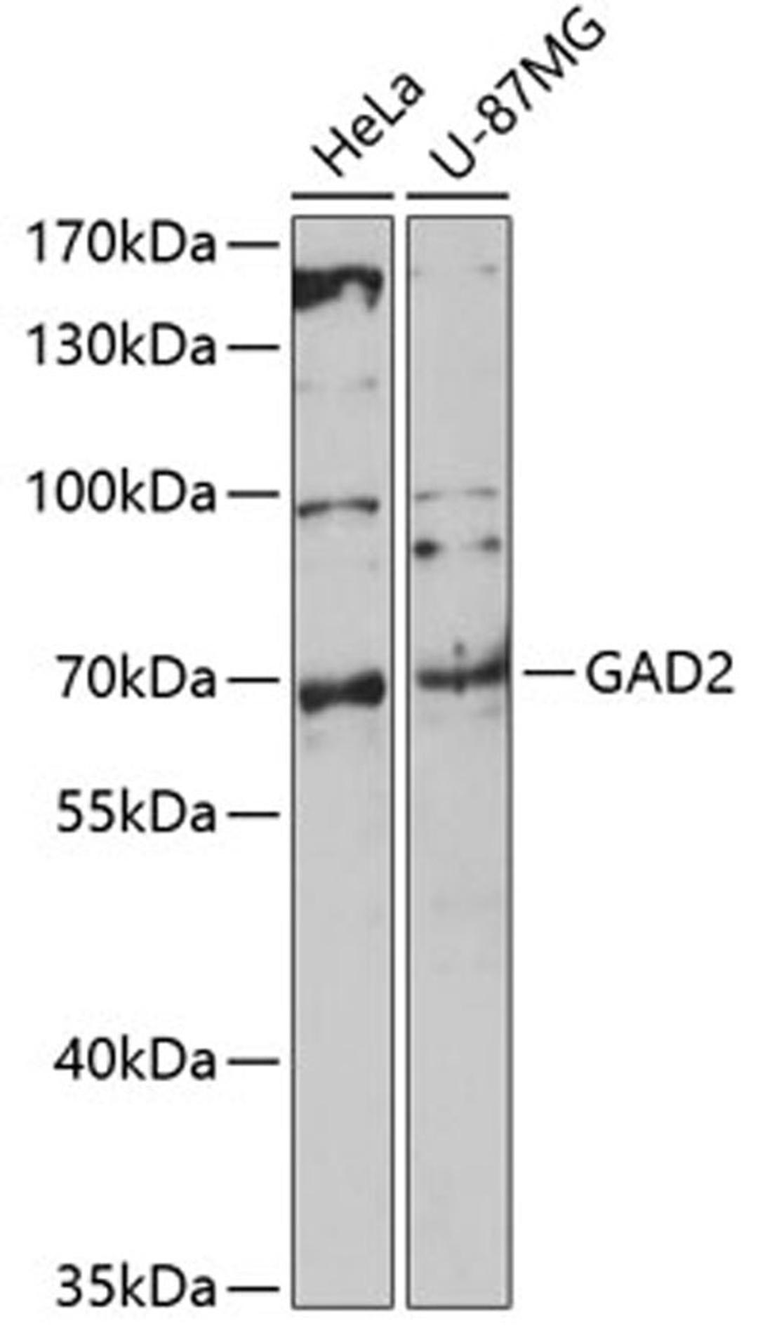 Western blot - GAD2 antibody (A0971)