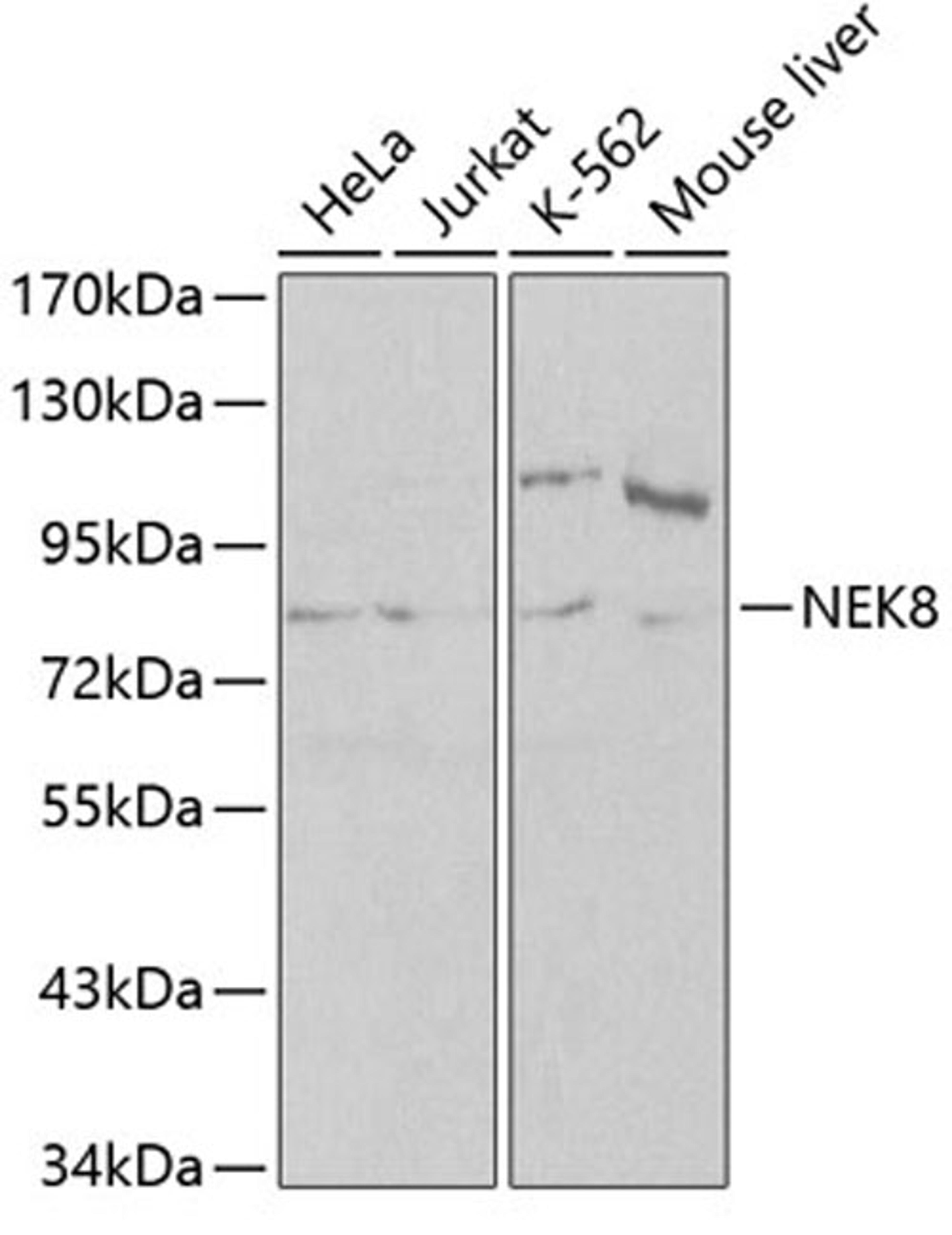 Western blot - NEK8 antibody (A0984)