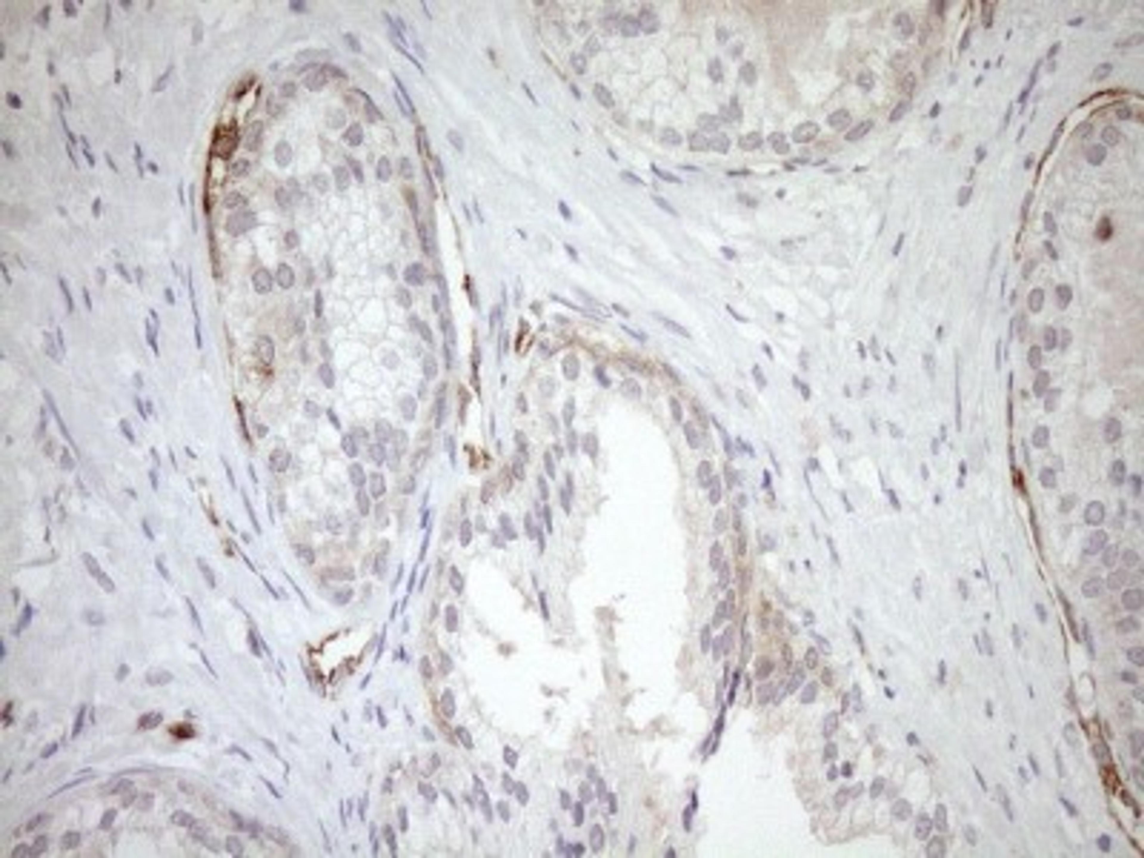 Immunohistochemistry: ASPDH Antibody (4G8) [NBP2-46550] - Analysis of Human prostate tissue. (Heat-induced epitope retrieval by 1mM EDTA in 10mM Tris buffer (pH8.5) at 120C for 3 min)