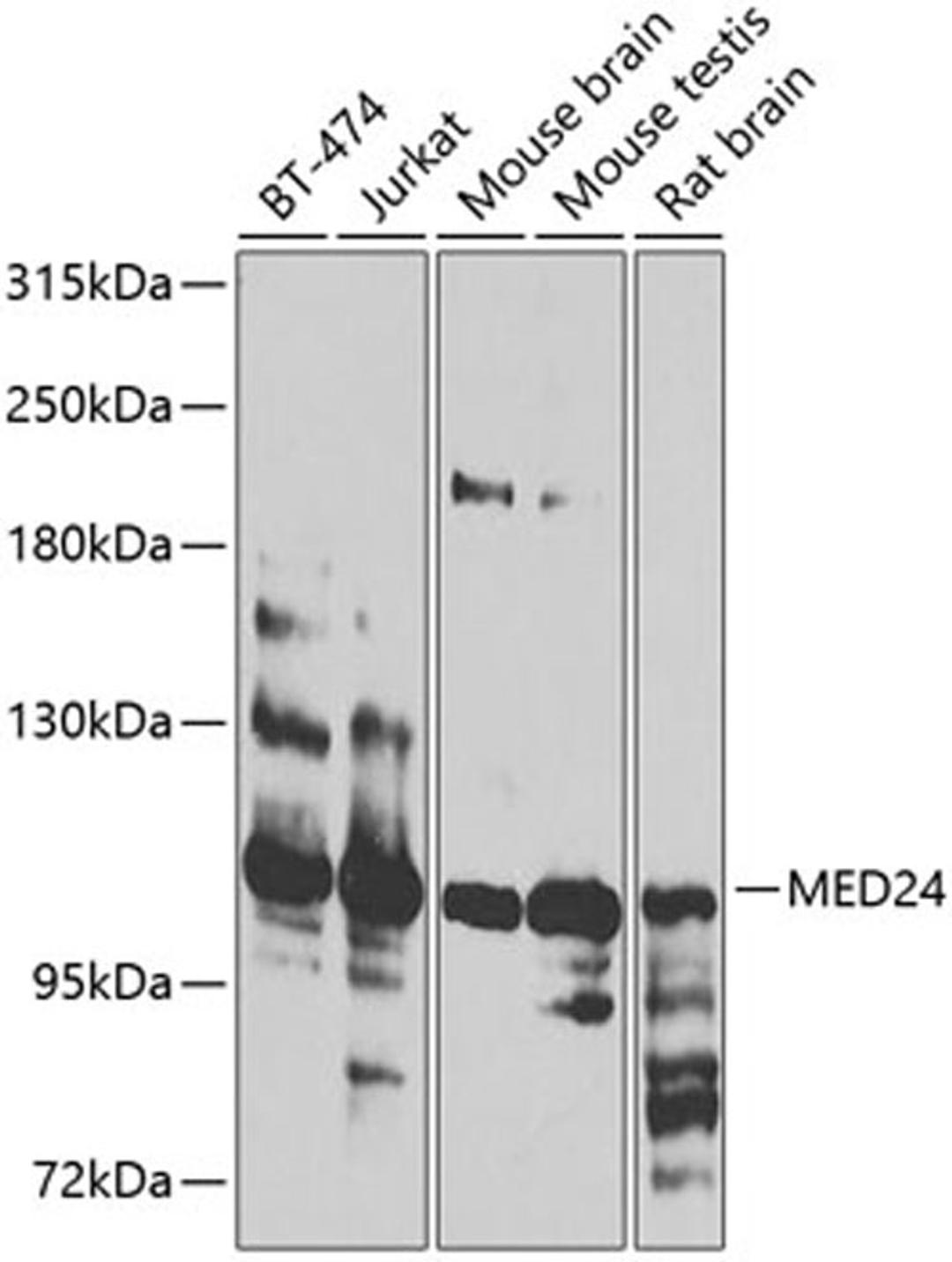 Western blot - MED24 antibody (A8059)