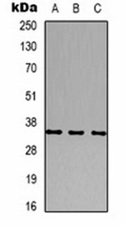 Western blot analysis of human brain (Lane 1), mouse brain (Lane 2), rat brain (Lane 3) whole cell lysates using CACNG2 antibody