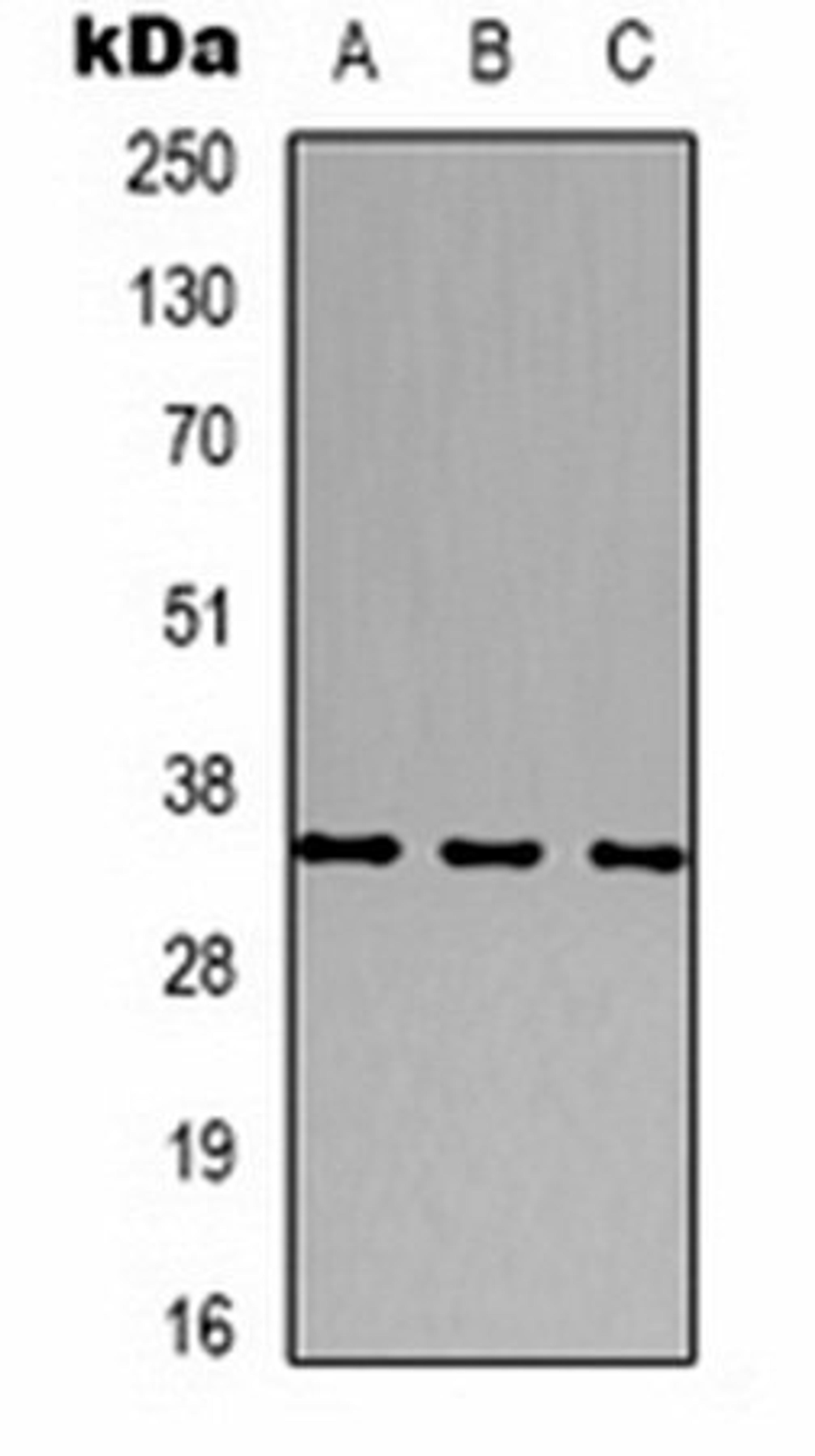 Western blot analysis of human brain (Lane 1), mouse brain (Lane 2), rat brain (Lane 3) whole cell lysates using CACNG2 antibody