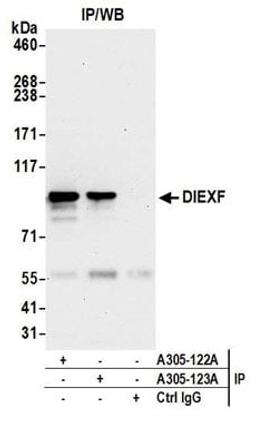 Detection of human DIEXF by western blot of immunoprecipitates.