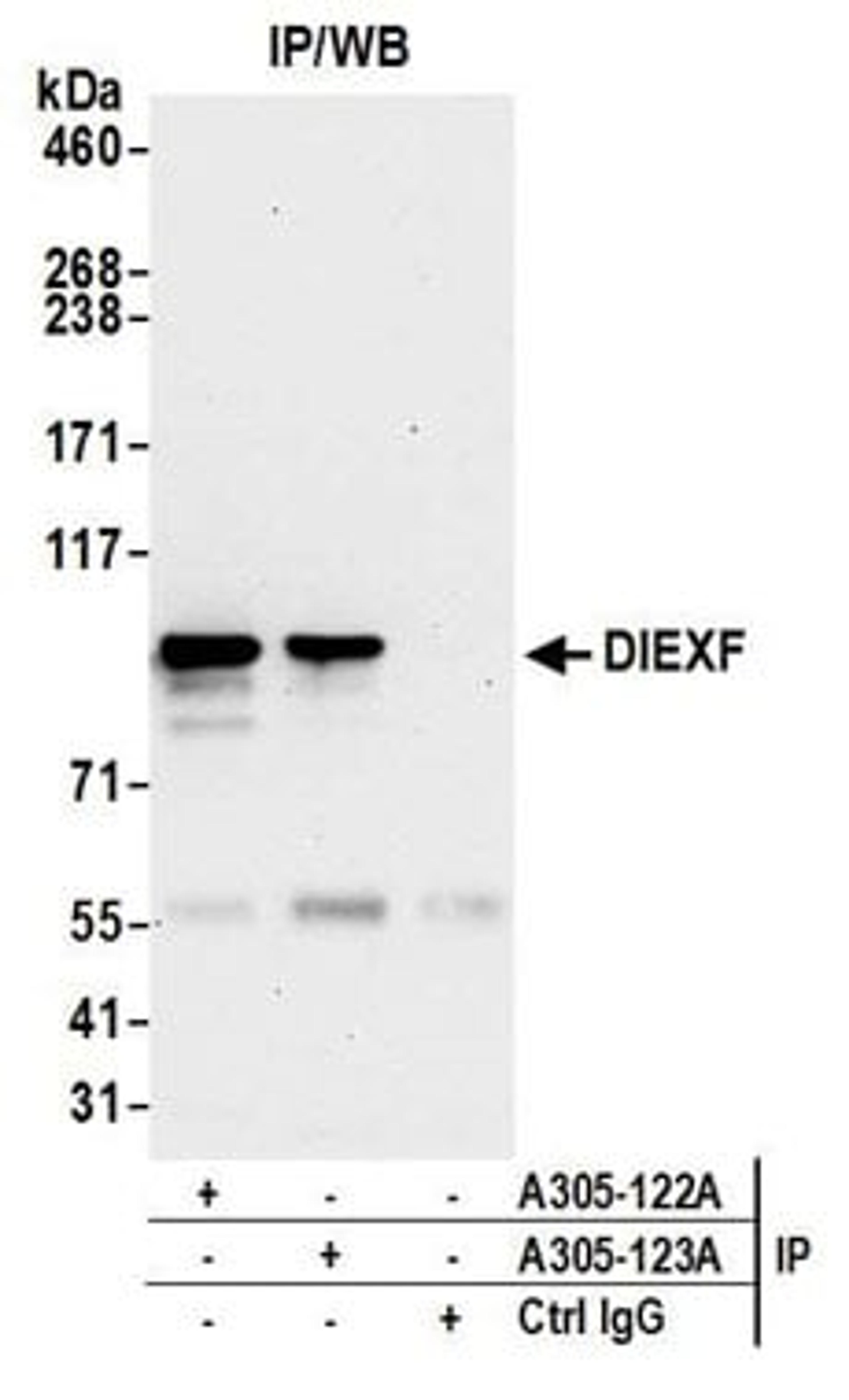 Detection of human DIEXF by western blot of immunoprecipitates.