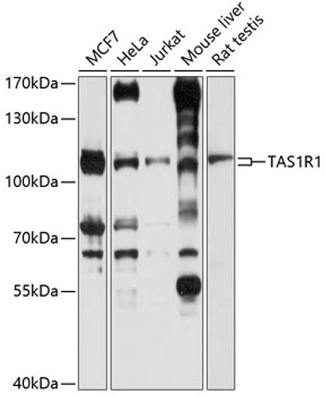 Western blot - TAS1R1 antibody (A10156)