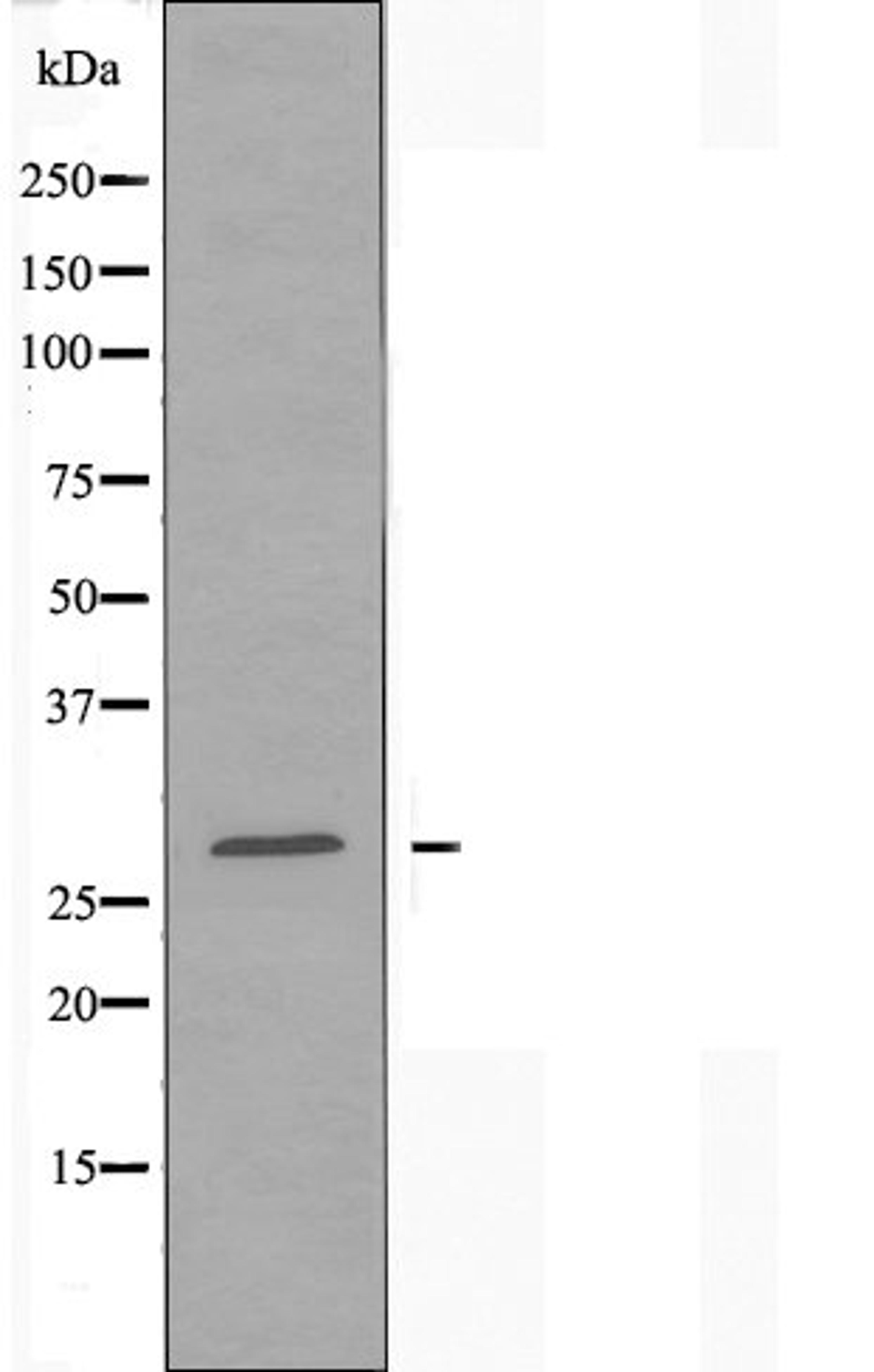 Western blot analysis of COLO cells and MCF-7 cells using OR5D3 antibody