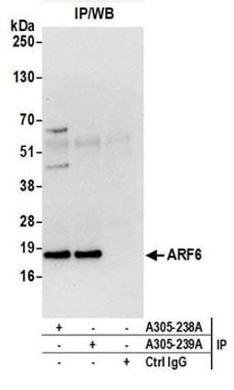 Detection of human ARF6 by western blot of immunoprecipitates.