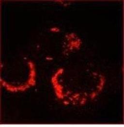 Immunofluorescence analysis of 6-h post infection Vero-E6 cells using Sars-Cov Nonstructural Protein 13 antibody