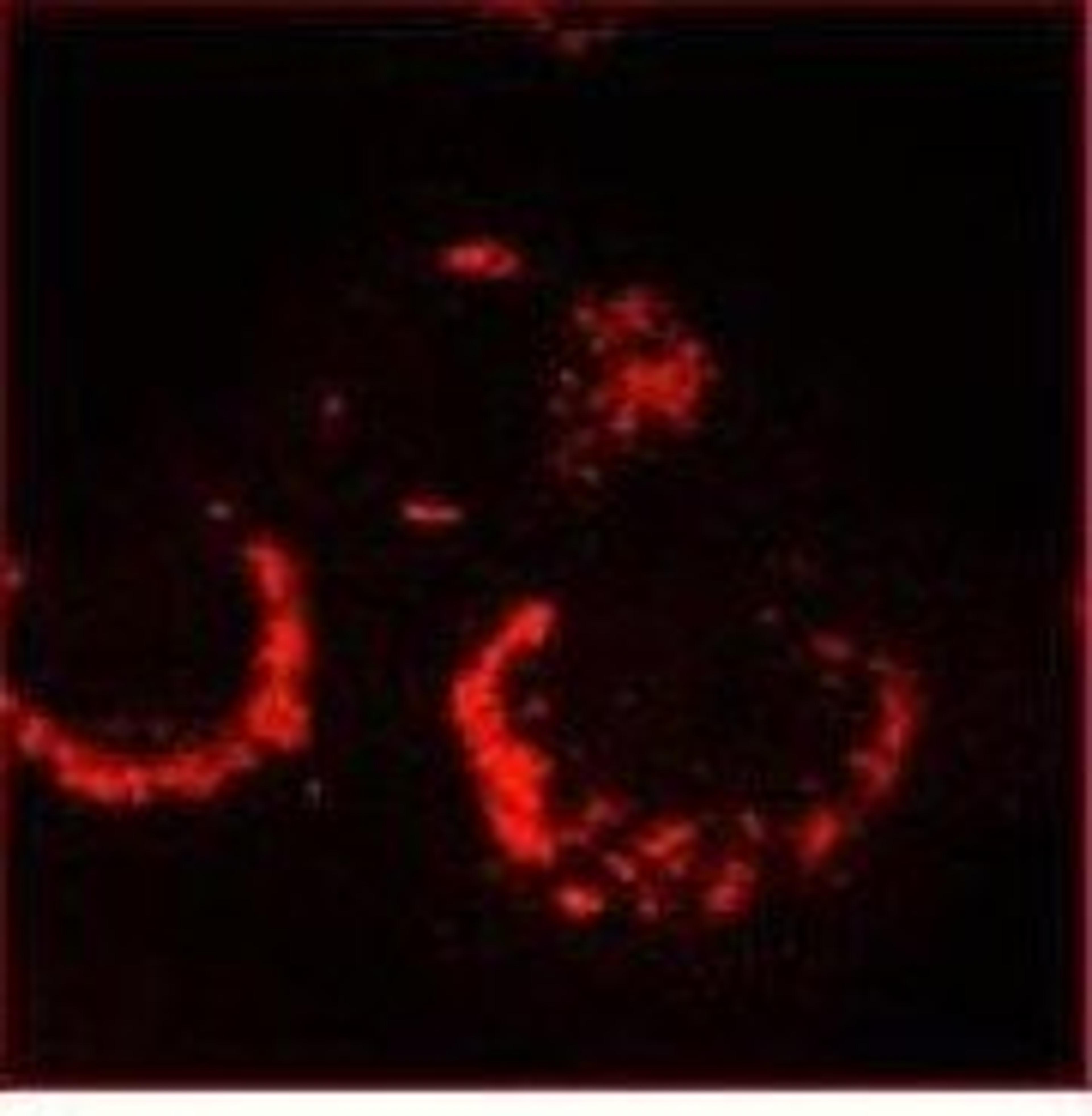 Immunofluorescence analysis of 6-h post infection Vero-E6 cells using Sars-Cov Nonstructural Protein 13 antibody