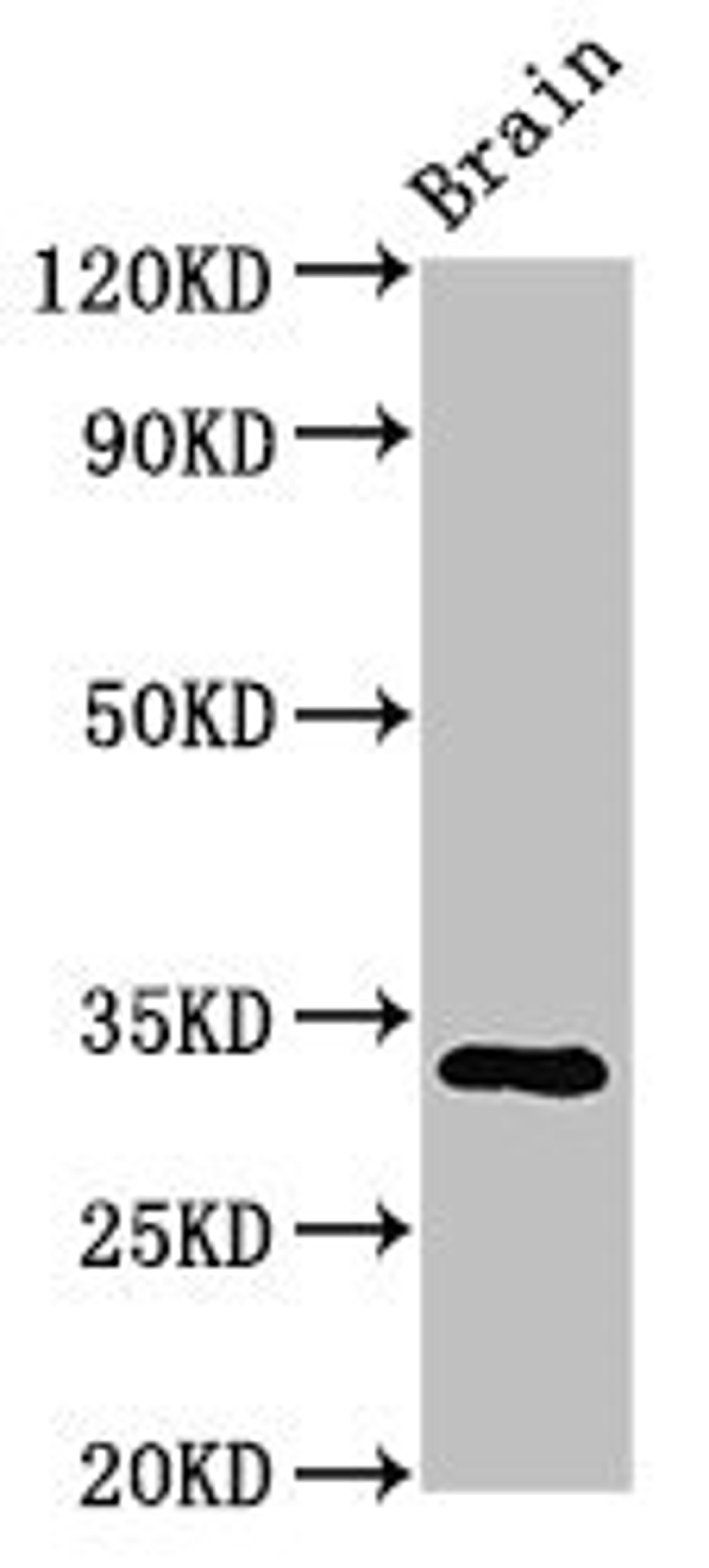 Western Blot. Positive WB detected in: Mouse brain tissue. All lanes: ORAI1 antibody at 3.2ug/ml. Secondary. Goat polyclonal to rabbit IgG at 1/50000 dilution. Predicted band size: 33, 26 kDa. Observed band size: 33 kDa. 