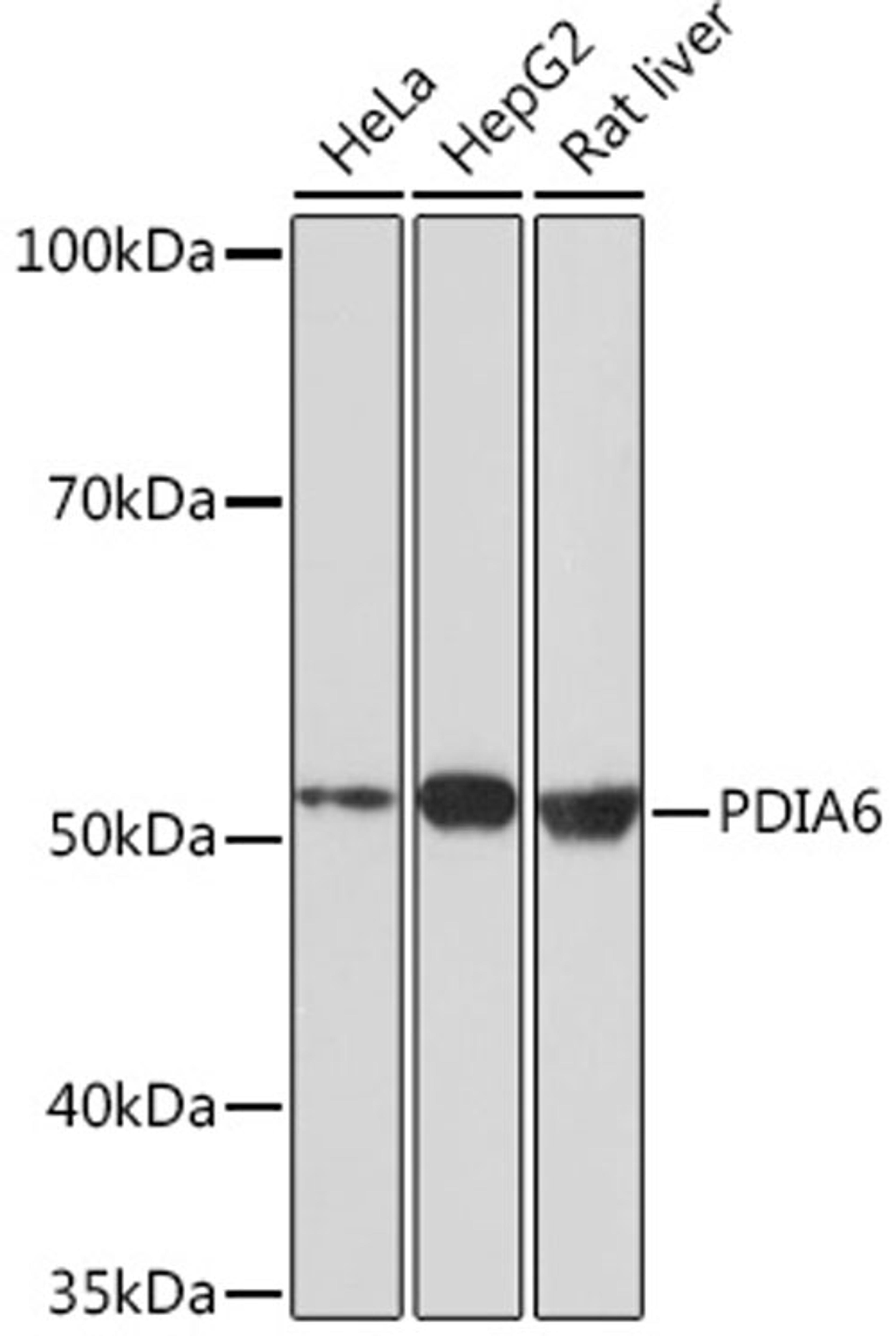 Western blot - PDIA6 Rabbit mAb (A4260)