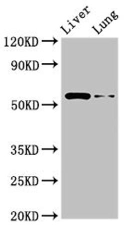 Western Blot. Positive WB detected in: Rat liver tissue, Rat lung tissue. All lanes: CCZ1 antibody at 2.5µg/ml. Secondary. Goat polyclonal to rabbit IgG at 1/50000 dilution. Predicted band size: 56 kDa. Observed band size: 56 kDa