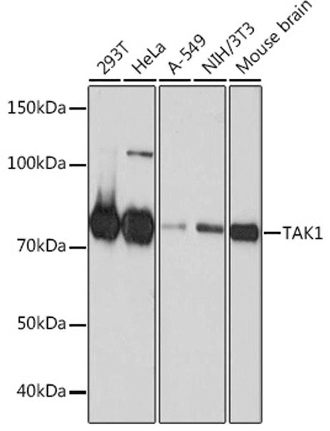 Western blot - TAK1 antibody (A19077)