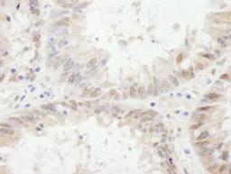 Detection of human ETV6 by immunohistochemistry.