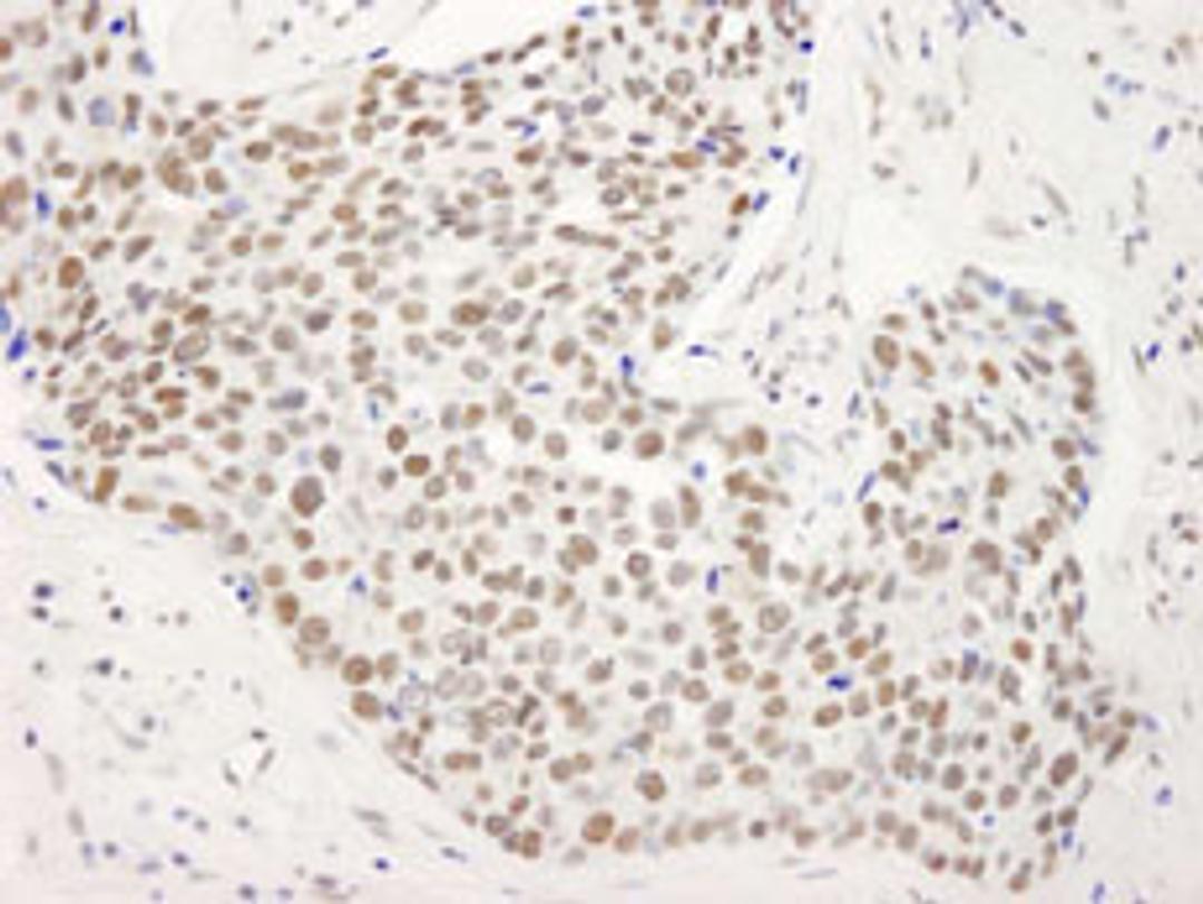 Detection of human SMAR1/BANP by immunohistochemistry.