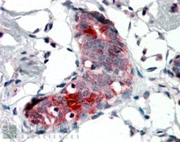 45-859 (4ug/ml) staining of paraffin embedded Human Breast. Steamed antigen retrieval with citrate buffer pH 6, AP-staining.