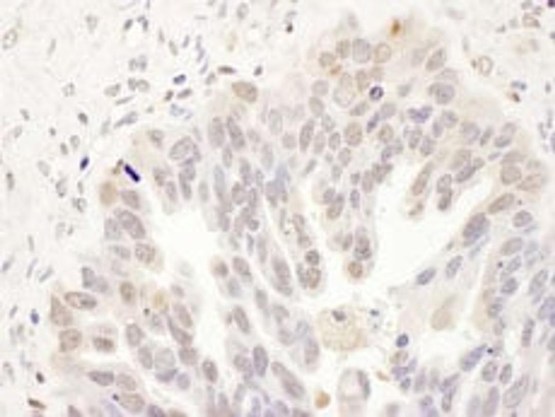 Detection of human DCK by immunohistochemistry.