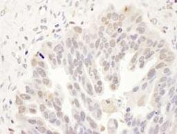 Detection of human DCK by immunohistochemistry.