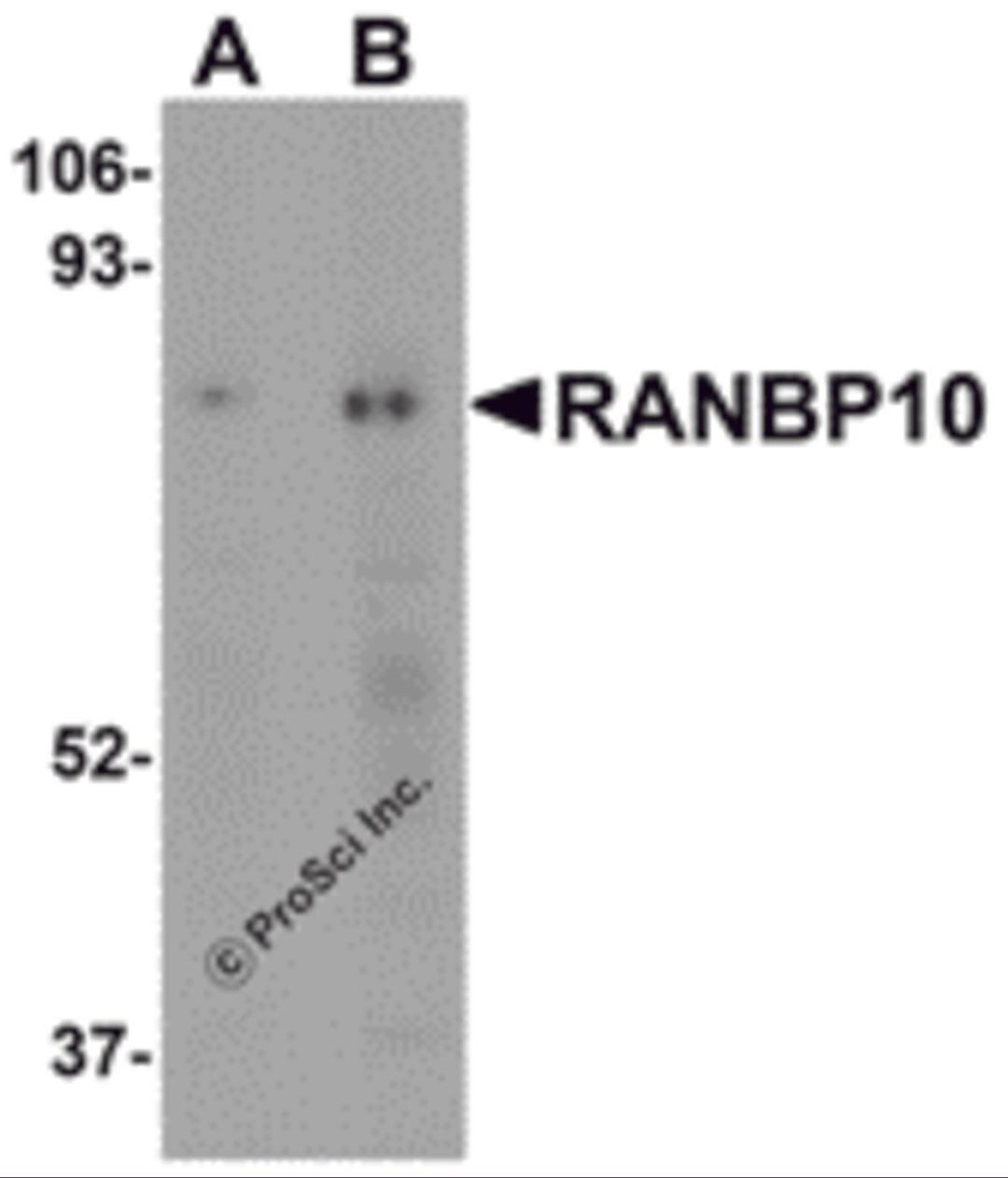 Western blot analysis of RANBP10 in human skeletal muscle tissue lysate with RANBP10 antibody at (A) 1 and (B) 2 &#956;g/mL.