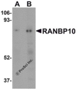 Western blot analysis of RANBP10 in human skeletal muscle tissue lysate with RANBP10 antibody at (A) 1 and (B) 2 μg/mL.