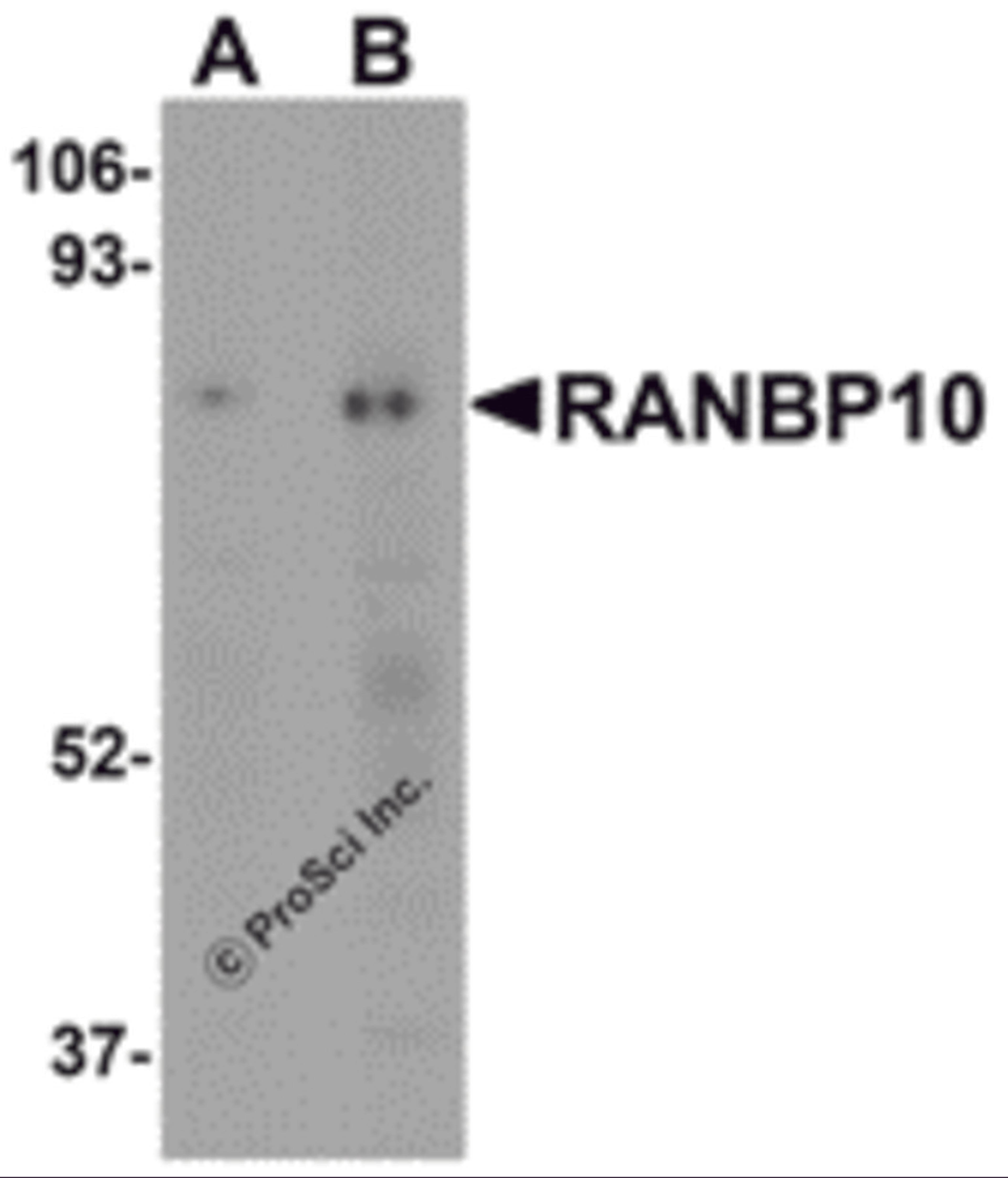 Western blot analysis of RANBP10 in human skeletal muscle tissue lysate with RANBP10 antibody at (A) 1 and (B) 2 μg/mL.