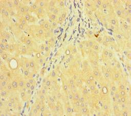 Immunohistochemistry of paraffin-embedded human liver tissue using CSB-PA884496LA01HU at dilution of 1:100