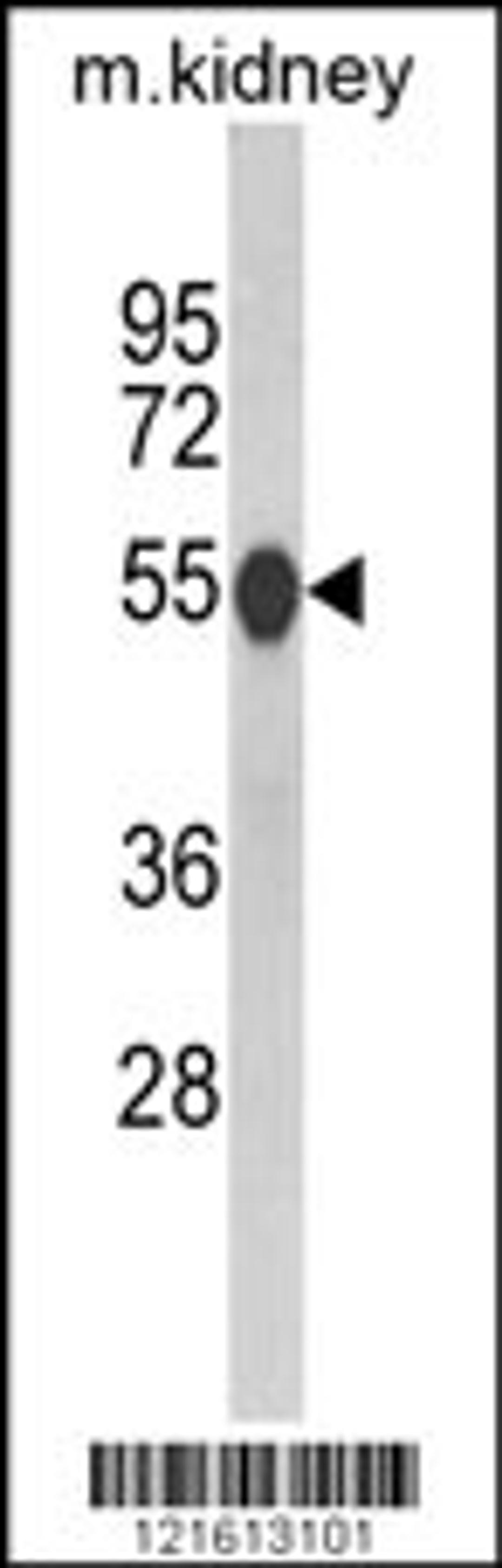 Western blot analysis of CAT Antibody in mouse kidney tissue lysates (35ug/lane)