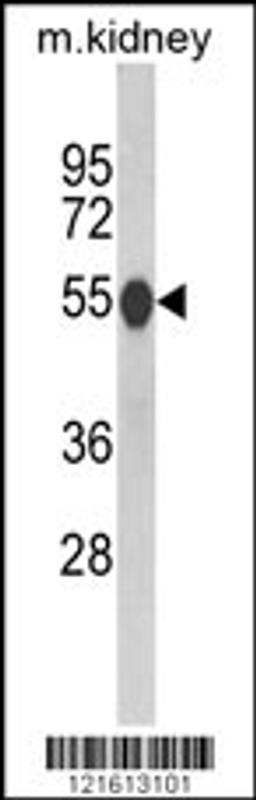 Western blot analysis of CAT Antibody in mouse kidney tissue lysates (35ug/lane)