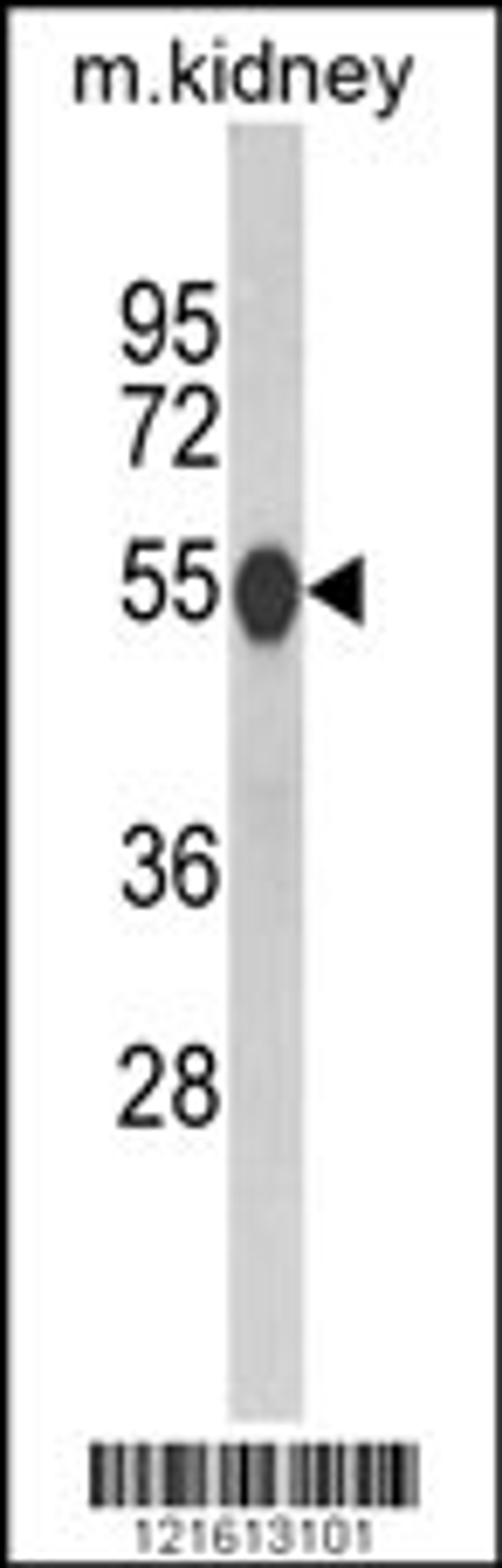 Western blot analysis of CAT Antibody in mouse kidney tissue lysates (35ug/lane)