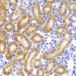 Immunohistochemical staining of rat kidney tissue using RPN1 antibody