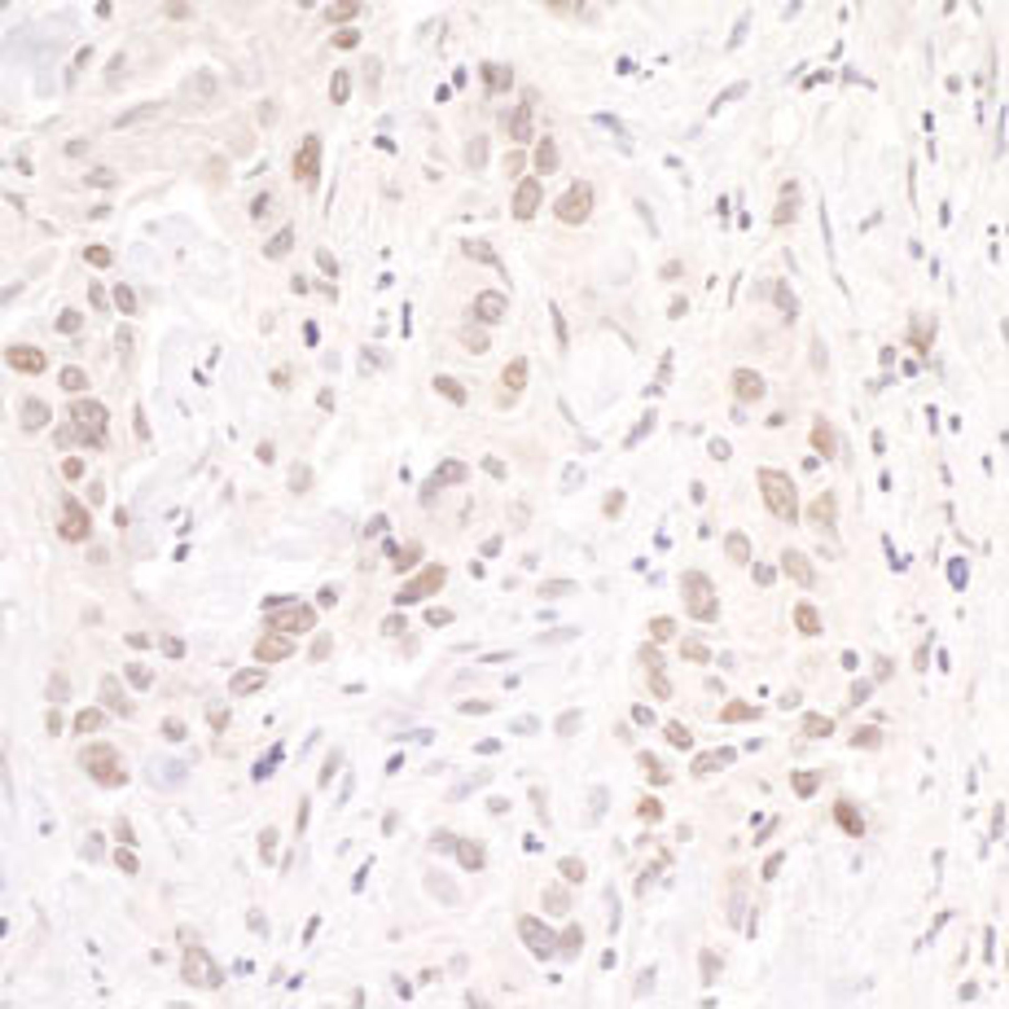 Detection of human p66beta/GATAD2B by immunohistochemistry.