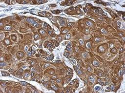 Immunohistochemistry-Paraffin: Colec12 Antibody [NBP2-15944] - Immunohistochemical analysis of paraffin-embedded Cal27 xenograft, using antibody at 1:500 dilution.