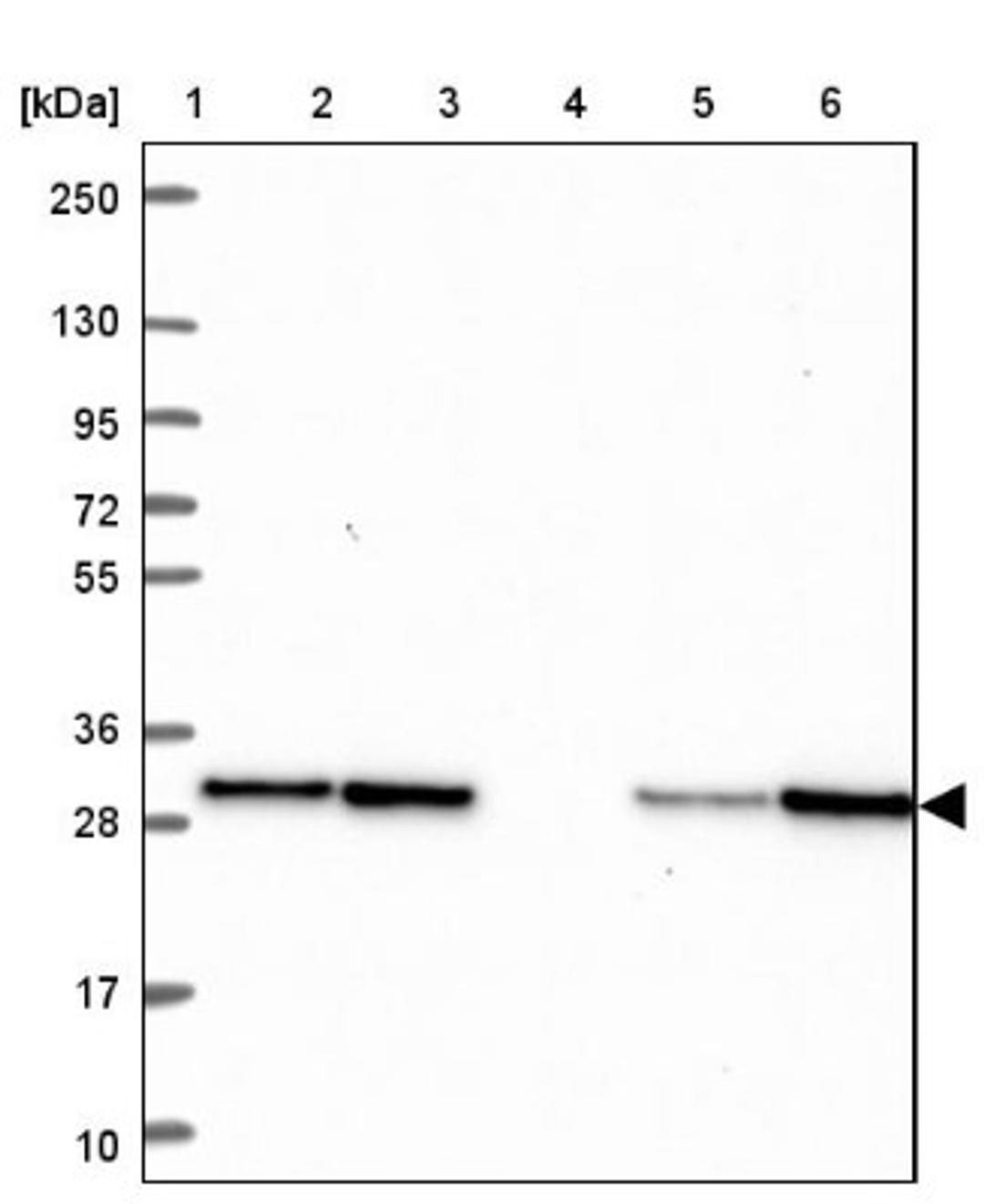 Western Blot: TPD52 Antibody [NBP2-38952] - Lane 1: Marker [kDa] 250, 130, 95, 72, 55, 36, 28, 17, 10<br/>Lane 2: RT-4<br/>Lane 3: U-251 MG<br/>Lane 4: Human Plasma<br/>Lane 5: Liver<br/>Lane 6: Tonsil