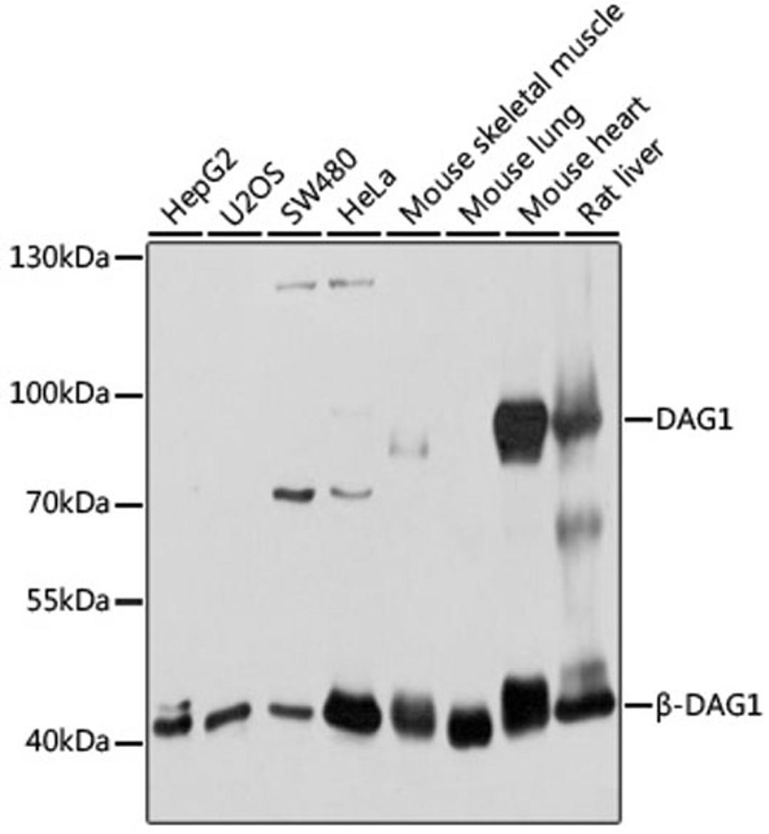 Western blot - DAG1 antibody (A10076)