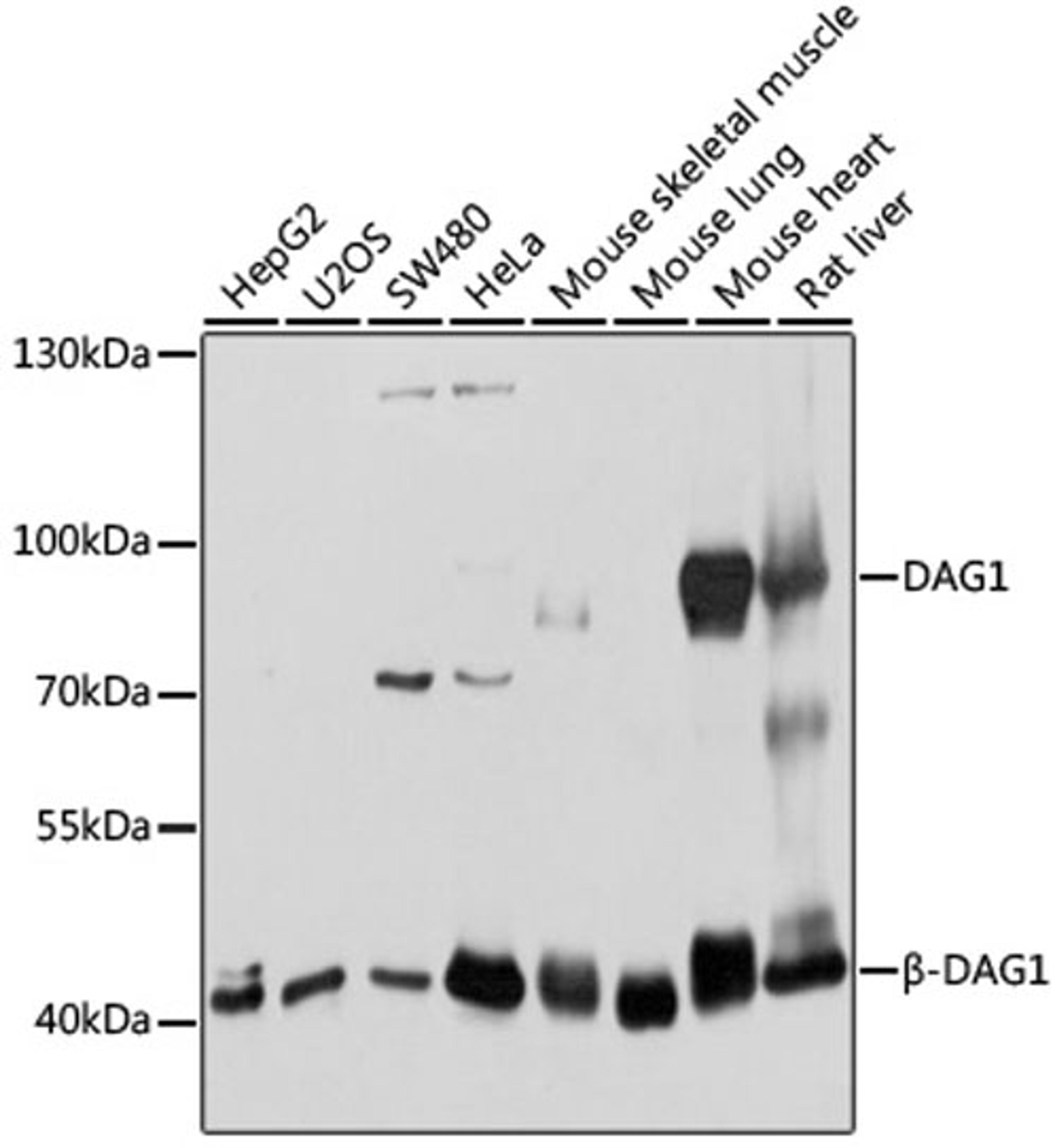 Western blot - DAG1 antibody (A10076)