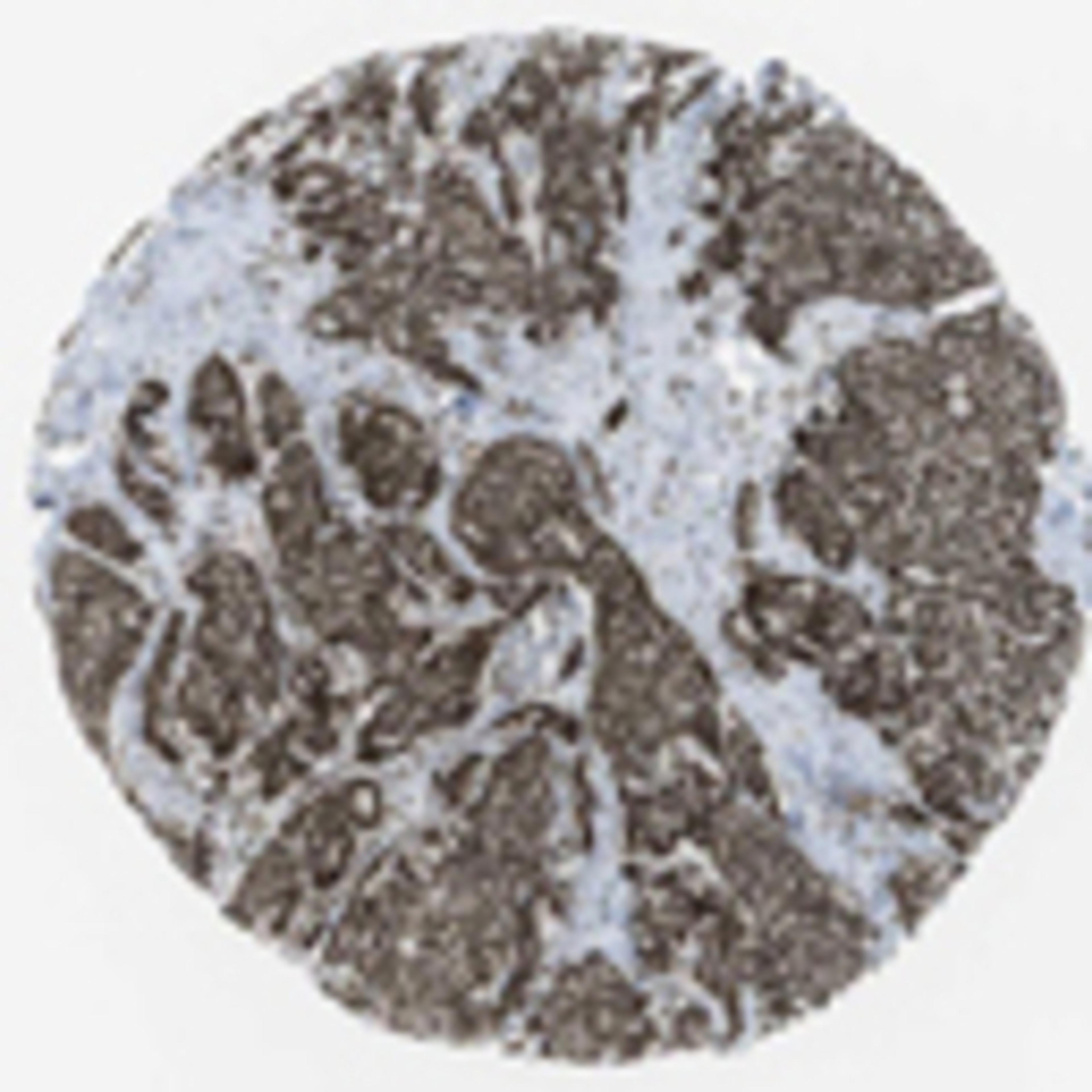 Immunohistochemistry: N-PAC Antibody [21580002] - Strong nuclear immunoreactivity was observed in normal and malignant tissues.  Image and statement courtesy of the Human Protein Atlas (HPA).