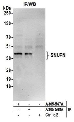 Detection of human SNUPN by western blot of immunoprecipitates.