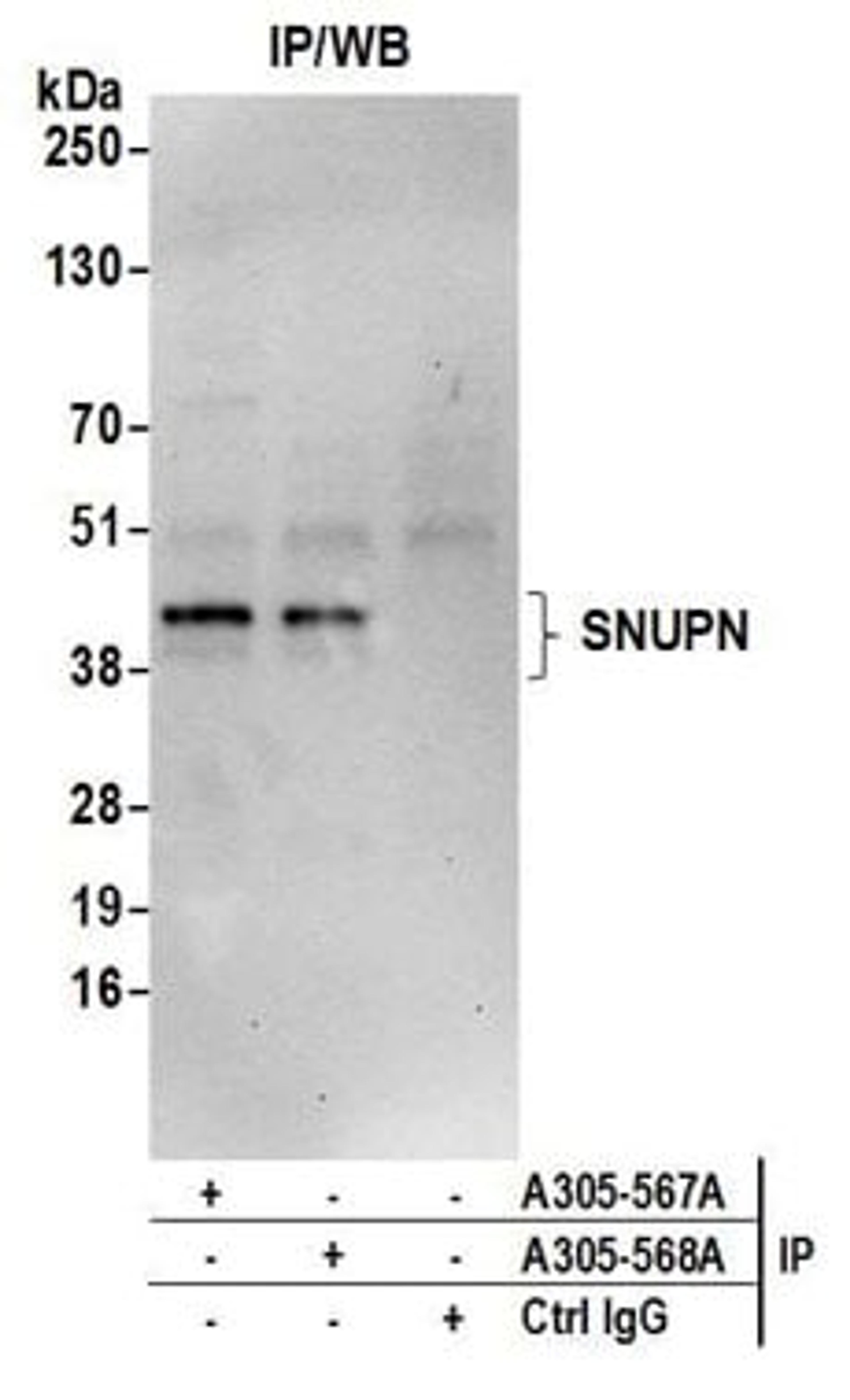 Detection of human SNUPN by western blot of immunoprecipitates.