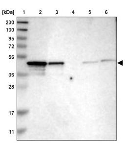 Western Blot: NDRG3 Antibody [NBP1-86046] - Lane 1: Marker [kDa] 230, 130, 95, 72, 56, 36, 28, 17, 11<br/>Lane 2: Human cell line RT-4<br/>Lane 3: Human cell line U-251MG sp<br/>Lane 4: Human plasma (IgG/HSA depleted)<br/>Lane 5: Human liver tissue<br/>Lane 6: Human tonsil tissue