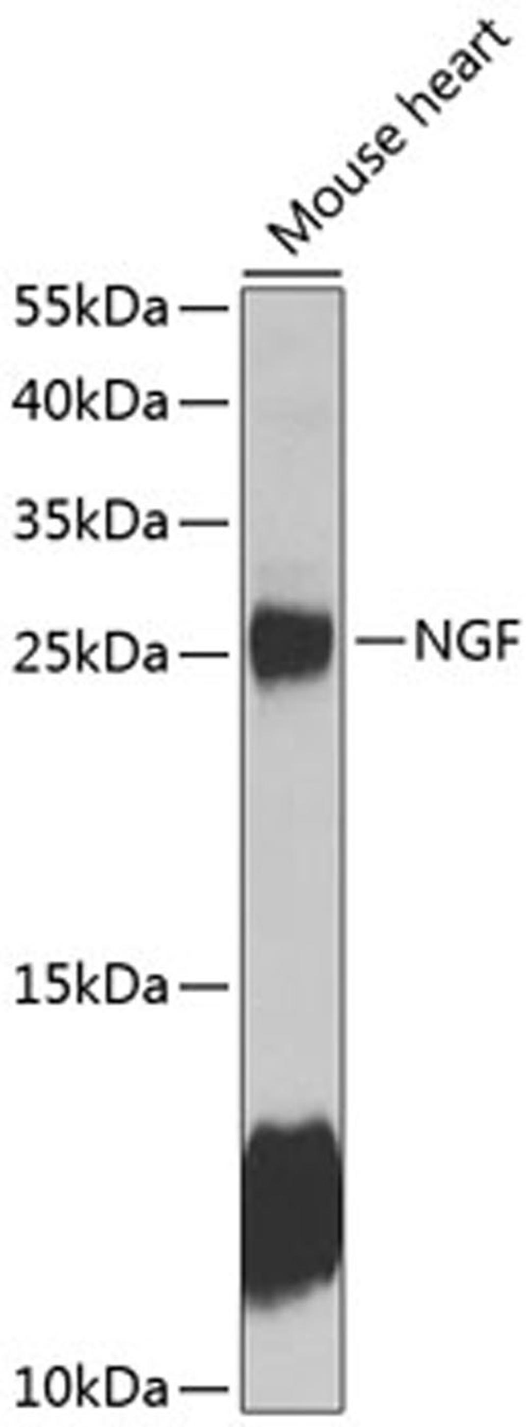 Western blot - NGF antibody (A13922)