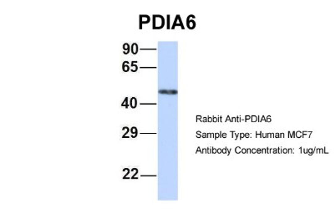 Western Blot: PDIA6 Antibody [NBP1-57968] - MCF7, Antibody Dilution: 1.0 ug/ml PDIA6 is strongly supported by BioGPS gene expression data to be expressed in MCF7.