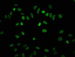 Immunofluorescence staining of Hela cells with CSB-PA010418OA04acHU at 1:7.5, counter-stained with DAPI. The cells were fixed in 4% formaldehyde, permeabilized using 0.2% Triton X-100 and blocked in 10% normal Goat Serum. The cells were then incubated with the antibody overnight at 4&deg;C. The secondary antibody was Alexa Fluor 488-congugated AffiniPure Goat Anti-Rabbit IgG(H+L).
