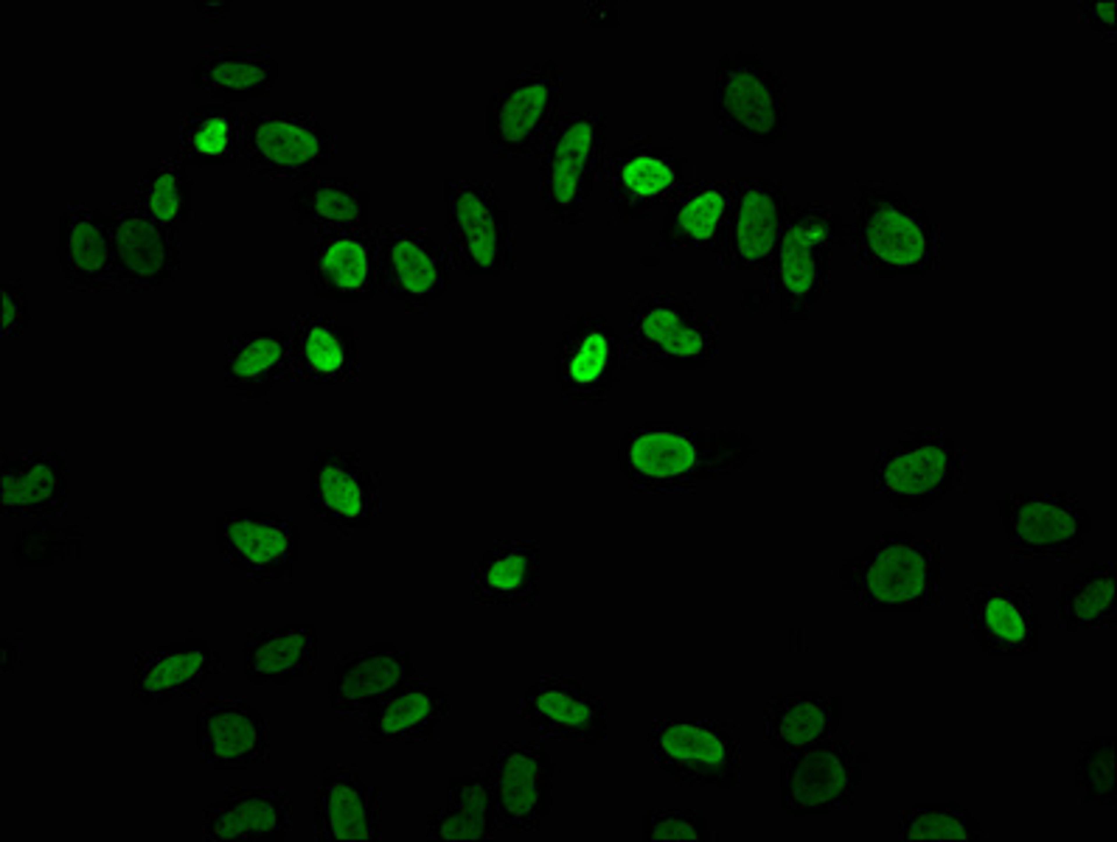 Immunofluorescence staining of Hela cells with CSB-PA010418OA04acHU at 1:7.5, counter-stained with DAPI. The cells were fixed in 4% formaldehyde, permeabilized using 0.2% Triton X-100 and blocked in 10% normal Goat Serum. The cells were then incubated with the antibody overnight at 4&deg;C. The secondary antibody was Alexa Fluor 488-congugated AffiniPure Goat Anti-Rabbit IgG(H+L).