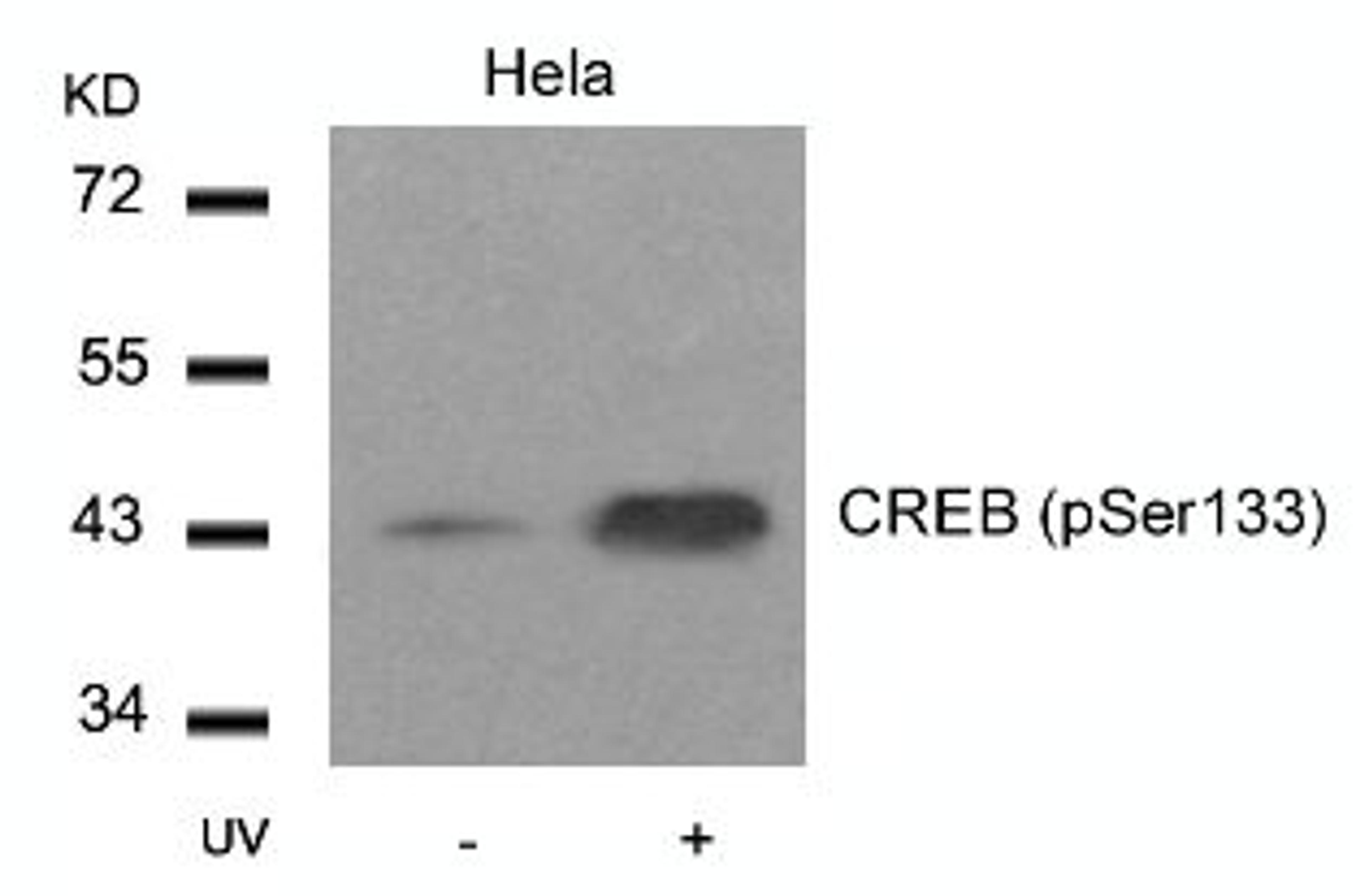 Western blot analysis of lysed extracts from HeLa cells untreated or treated with UV using CREB (Phospho-Ser133).